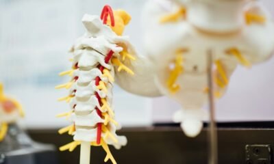 Non-Surgical Disc Pain Care for Broward County Patients